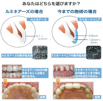 ルミネアーズ