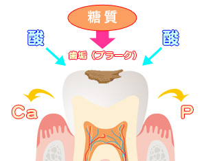 脱灰