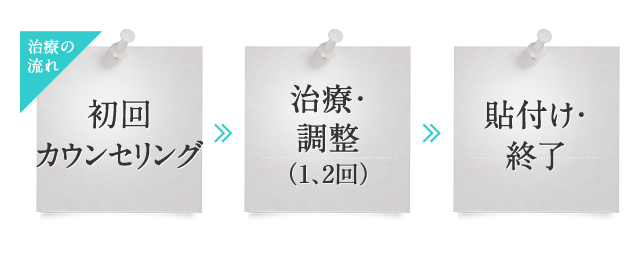 治療の流れ。初回カウンセリング、治療・調整（1、2回）、貼付け・終了