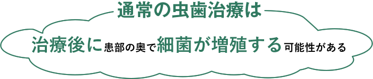 通常の虫歯治療は治療後に患部の奥で細菌が増殖する可能性がある